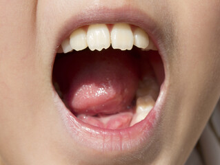 Obraz premium close up child open mouth.