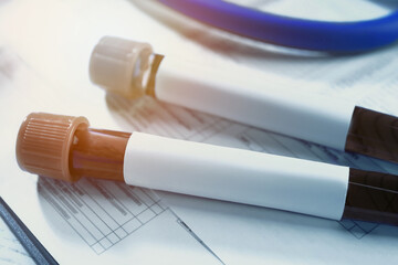 Test tubes with blood samples on medical form