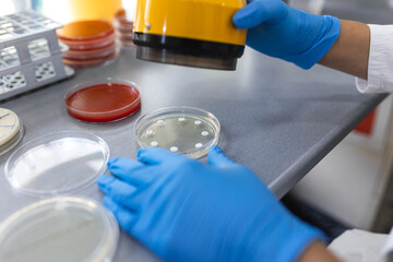 Medical Science Laboratory, Antibiotic susceptibility testing. Scientist Does testing antibiotics....