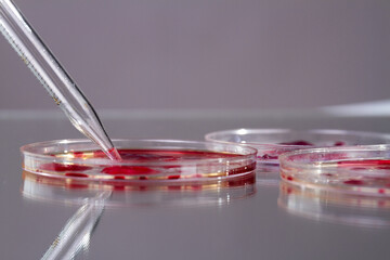 Close up petri dishes with blood and pipette. DNA analysis concept.