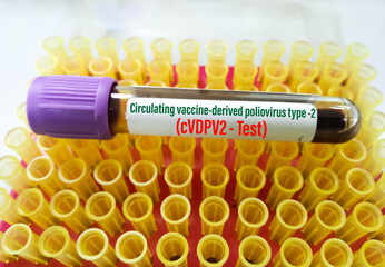 Blood sample tube for circulating vaccine-derived poliovirus type 2 (cVDPV2) test