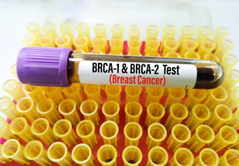 Blood sample for BRCA1 and BRCA2 test. Those are two genes that are important to fighting cancer...