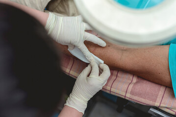 Applying clean dressing to a disinfected dog bite wound on the forearm of a patient at a bite...