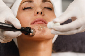 Obraz na płótnie Canvas Mesotherapy Non Needle Treatment In A Beauty Salon