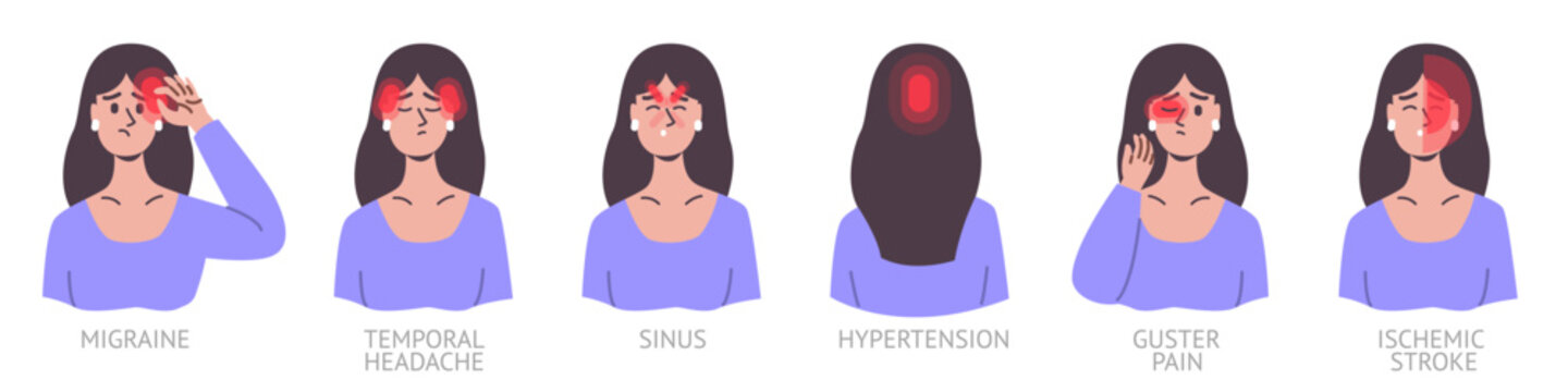 Headache types. Woman portrait with different areas pain. Girl with migraine. Sore head. Educational poster. Painful symptoms. Suffer from hypertension. Vector ache localizations set