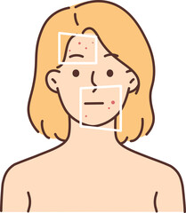 Woman with red pimples on face