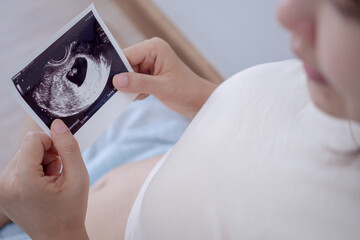pregnant woman is looking at an ultrasound photo of fetus. Mother gently touches the baby on...