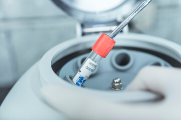 A lab technician places a tube containing a blood sample into a centrifuge. For hematology analysis...