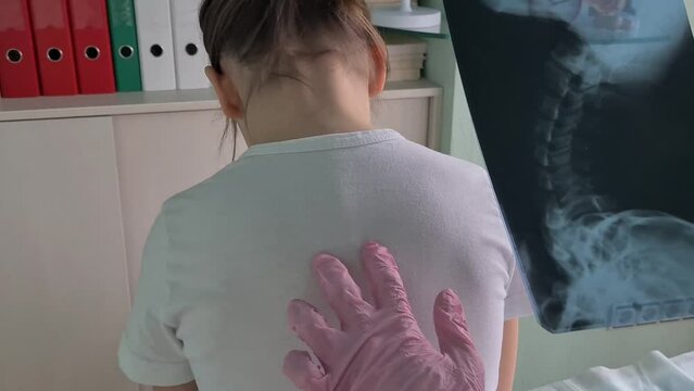 Pediatrician doctor examines x-ray of child spinal deformity	

