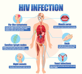 Informative poster of of HIV infection