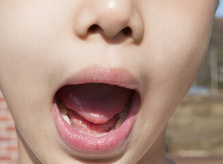
child face with open mouth