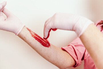 Shugaring master applying thick sugar paste on lady's hand, removing unwanted hair. Hair removal...