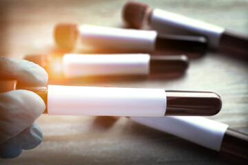 Laboratory worker holding test tube with blood sample over table, closeup