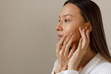 Acne skin of young woman in white bathrobe examines pimples on her face. Problematic skin on the face pustula. Portrait of girl removing pimples in the bathroom. Beauty and health of the skin.