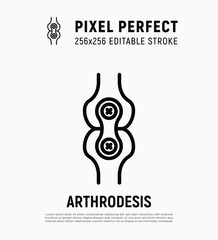 Arthrodesis joint surgery thin line icon. Arthritis. Pixel perfect, editable stroke. Vector illustration.