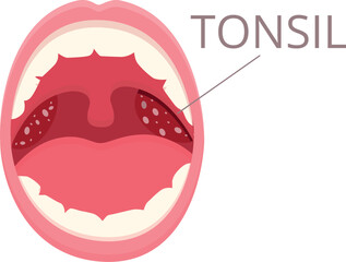 Mouth tonsillitis icon cartoon vector. Bacterial hygiene. Cancer medical - obrazy, fototapety, plakaty