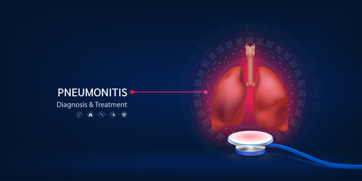 Pneumonitis tuberculosis disease. Human lungs model float away from stethoscope. Doctor diagnosis treatment. Medical technology innovation concept. Banner design for pharmacy clinic. 3d Vector.