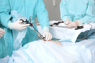 Modern abdominal surgery. Laparoscopy in surgery. Surgical intervention through small holes....