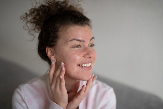 Young beautiful woman with akne skin making home beauty tretment