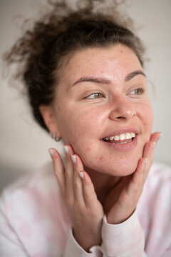 Young beautiful woman with akne skin making home beauty tretment