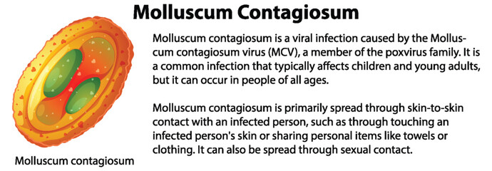 Molluscum Contagiosum with explanation