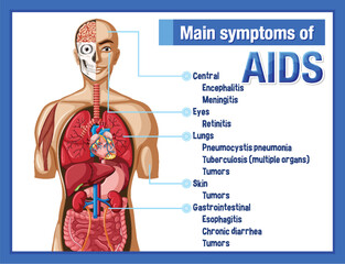 Informative poster of main symtoms of AIDS