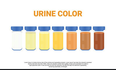 Illustration of urine color chart