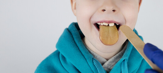 Blond boy has a yellow tongue. Painful yellow coating on the mucous membrane of the tongue....
