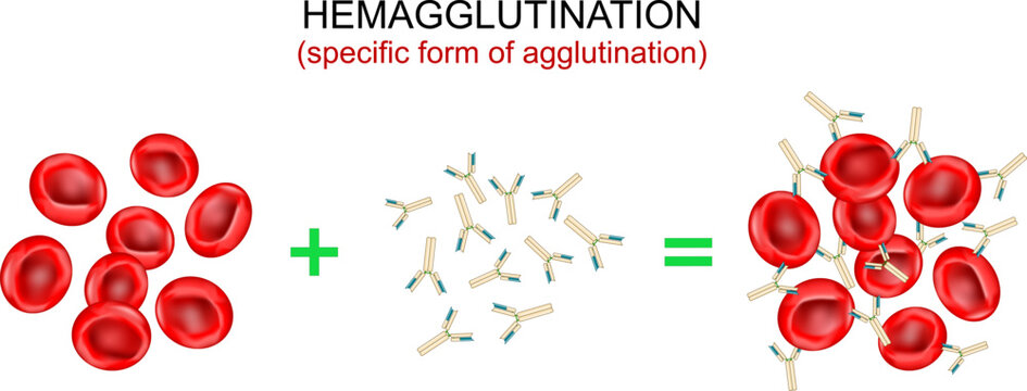 Hemagglutination, or haemagglutination. antibodies bind to antigens and form a clumping of erythrocytes.