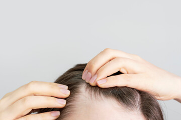 Girl touching her hair close-up on white background, hair loss concept.