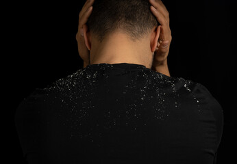Close up low key portrait of man with dandruff or itchy hair problem. Concept of hair care,  dandruff and seborrheic dermatitis. - obrazy, fototapety, plakaty