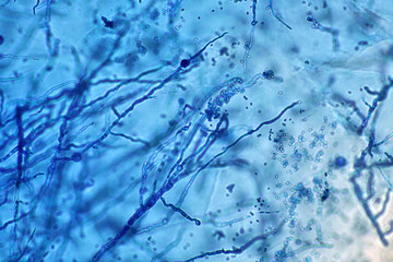 Microscope of black fungus spore strain with Lactophenol cotton blue, molds or yeasts with macro...