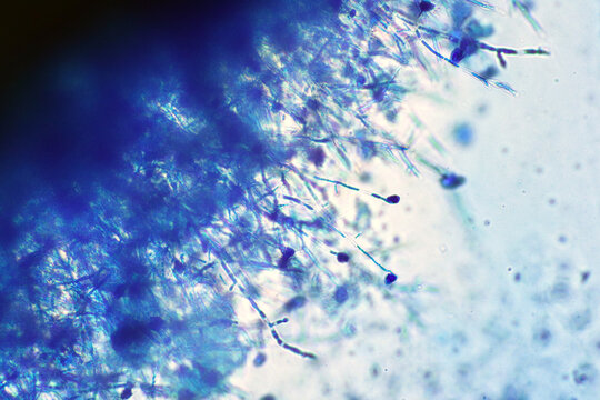 Microscope of black fungus spore strain with Lactophenol cotton blue, molds or yeasts with macro 40x lens, contamination in air room, pollution aerosol environmental. Microbiology laboratory concepts.