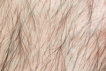 Macro human skin and hair,Hair on the body of the macro