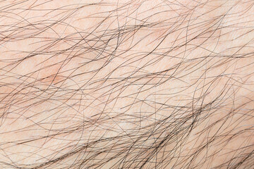 Macro human skin and hair,Hair on the body of the macro