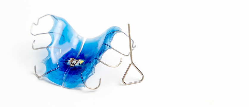 Dental plate. Expansion of the jaw in a child. A plate to heaven. There is not enough room for the molars. Happy girl holding an orthodontic plate in her hands