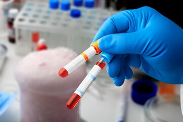 Doctor holding test tube with blood