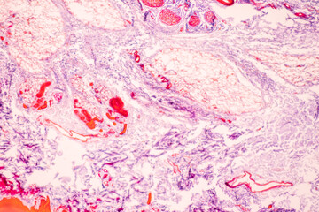 Characteristics Tissue of Skin from finger Human and Nail development finger of Human under the microscope in Lab.