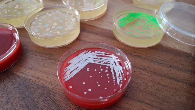 Agar petri dish with microbial streaks and colonies; blood agar and Luria broth agar plates