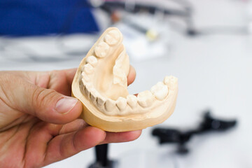 Plaster model of the human jaw with teeth. Dentist's device in the hand. High quality close-up photo.