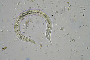 soil fungi, microorganisms and nematodes in a soil and compost sample.