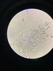 Microscopic view of struvite crystals from urinary sediment. Magnesium ammonium phospate crystals. Causing Feline Lower Urinary Tract Disease
