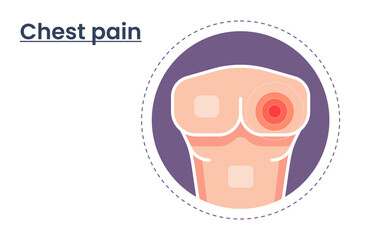 Vector illustration of chest pain. body point pain template. medical infographics concept. physiotherapy concept.