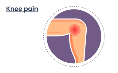 Vector illustration of knee pain. body point pain template. medical infographics concept. physiotherapy concept.