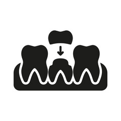 Orthodontic Denture, Dental Crown Silhouette Icon. Tooth Medical Crown. Teeth Protection Implant. Dental Treatment Sign. Oral Care Glyph Pictogram. Dentistry Symbol. Isolated Vector Illustration