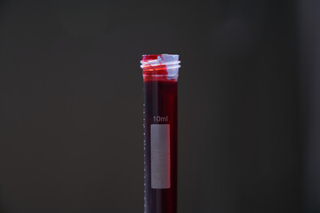 A test tube with blood on a dark background. Transparent test tubes without a lid with a label for data identification. Selective focus. With a space to copy. High quality photo