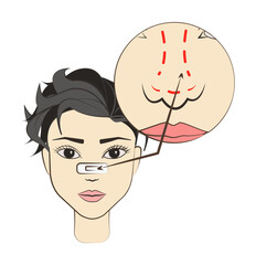 surgery correcting nose colored icon