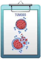 Tumor cell and cancer development