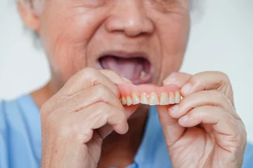 Fotobehang Asian senior woman patient wearing teeth denture into her mouth for chew food. © manassanant