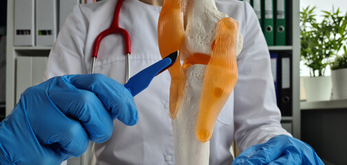 Surgeon holding scalpel near model of knee joint in clinic